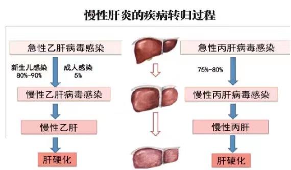 【健康科普】世界肝炎日——坚持早预防,加强检测发现,规范抗病毒治疗